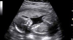 Obyčajný status neznámej ženy sa stal hitom. Odrovná aj vás