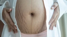Lekári hovoria o epidémii: Obezita ohrozuje tehotné Slovenky aj ich deti
