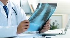 Rakovina pľúc nevzniká len pre fajčenie či znečistené ovzdušie. Vedci odhalili novú príčinu