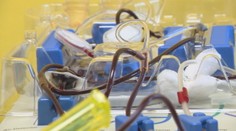 Národný onkologický ústav hľadá darcov krvných doštičiek