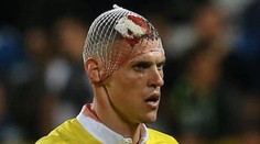 FOTO: Škrtel opäť potvrdil povesť bojovníka. Zápas dohral s rozťatou hlavou