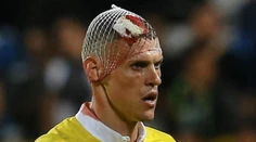FOTO: Škrtel opäť potvrdil povesť bojovníka. Zápas dohral s rozťatou hlavou