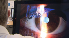 Lekárka, ktorá vyoperovala pacientovi nesprávne oko, spoznala trest