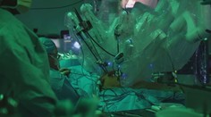 Zábery ako zo sci-fi filmu. Viacruký robot zohral kľúčovú úlohu pri transplantácii pľúc