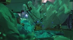 Zábery ako zo sci-fi filmu. Viacruký robot zohral kľúčovú úlohu pri transplantácii pľúc