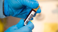 WHO odporučila liečbu protilátkami proti covidu pre vysokorizikových pacientov