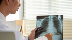 S prípadom chlapca, ktorý vykašliaval krv, si lekári dlho nevedeli rady. V pľúcach objavili nečakaného votrelca