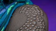 Fotograf zachytil obrovskú bolesť: Takto sa "skrášľuje" žiletkou