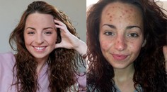 Krásne dievča sa do krvi zohavuje. Nedokáže s tým prestať