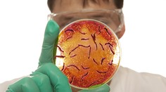 V Iraku vypukla epidémia cholery. Ochorelo vyše 1800 ľudí, šesť zomrelo