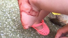 Sandále dievčatku hrozivo poranili nohy. Dostupné sú aj na Slovensku!