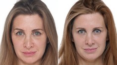 Redaktorka objavila elixír mladosti a omladla o päť rokov!