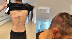 Hovorili sme s rodičmi muža, ktorého mal zmlátiť policajt. Po výsluchu ho ani nespoznali