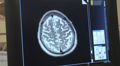 Vedci určili vek, kedy mozog človeka začína starnúť. Rozhodujúca je jedna vec