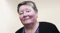 Chlipnete si z alkoholu a už máte na tvári červený fľak? Príčina je nebezpečná