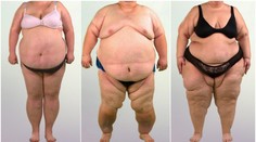 Pravda o závislosti na jedle: Odborníčka radí, ako sa zbaviť večného jo-jo efektu