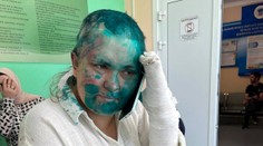 Ruskú investigatívnu novinárku a právnika brutálne zbili v Čečensku. Žena je v zlom stave