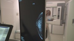 Zvrat pri dôležitom vyšetrení pre tisíce Sloveniek. Štát chystá zmenu, poteší najmä tieto ročníky