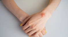 Nahmatali ste si hrčku pod kožou? Jeden detail prezradí viac než si myslíte