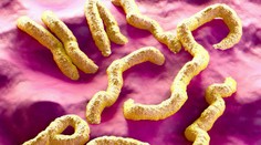 V západnej Afrike sa objavil nebezpečný vírus. Môže mať smrtnosť až 88 percent