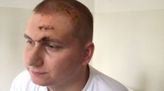 Pacient takmer zomrel pre nesprávne určenú diagnózu, zachránila ho mama