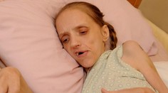 Má iba 35 rokov, no alkohol z nej urobil zlomenú starenu