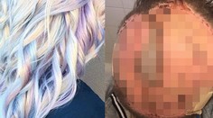 Mamička vyskúšala populárnu farbu na vlasy. Výsledkom bola oskalpovaná hlava