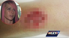 Gumička do vlasov ju takmer pripravila o život