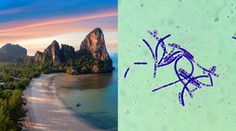 Obľúbená dovolenková destinácia bojuje so zákernou nákazlivou chorobou. Hlásia už aj mŕtveho