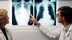 Medzi deťmi narastá počet prípadov nákazlivej choroby. Situácia sa ešte môže zhoršiť