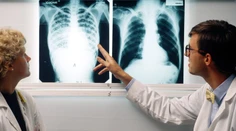 Medzi deťmi narastá počet prípadov nákazlivej choroby. Situácia sa ešte môže zhoršiť