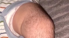VIDEO: Bábätko trpiace ojedinelým stavom trápi ďalší problém. Lieky spôsobili masívne ochlpenie