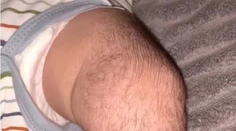 VIDEO: Bábätko trpiace ojedinelým stavom trápi ďalší problém. Lieky spôsobili masívne ochlpenie
