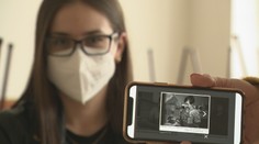 Vzdali umeleckú úctu zdravotníkom. Zachytil ich objektív aj talentované pero básnikov