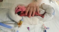 Keby sa narodila o dva dni skôr, lekári by jej nepomohli. Dnes je krásne dievčatko