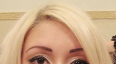 Tieto ženy zdeformovali svoju krásu. Perami by tromfli aj káčera!