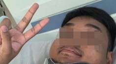 Neuveriteľný príbeh: Muž (24) po nehode zostal ležať na zemi, život mu zachránili moderné technológie