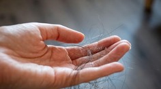 Vypadáva vám viac vlasov ako zvyčajne? Odborníci radia, čo robiť
