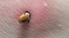 Z približne 20 druhov kliešťov je najnebezpečnejší kliešť obyčajný