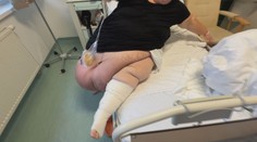 Monika bola za pár hodín ľahšia o 42 kilogramov. Lekári jej odstránili veľký brušný previs