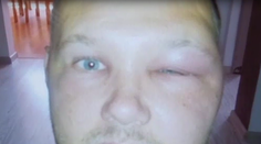 Včely terorizujú obyvateľov. Ich majiteľ s tým nič nerobí