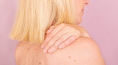 Rakovina, ktorú môžeme vidieť voľným okom. Ktoré kožné zmeny by ste nikdy nemali ignorovať?