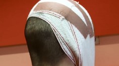 Kopance do hlavy a dokaličený mladík. Polícia už obvinila dvoch mužov