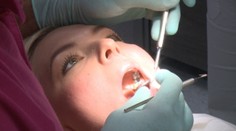 Dajte si skontrolovať zuby ešte pred dovolenkou. Toto ich ničí