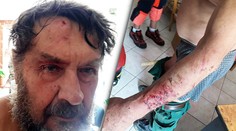 Fotograf, ktorého na Poľane napadol medveď, opísal horové chvíle