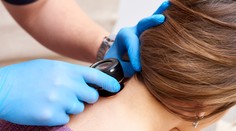 Jeseň je ideálne obdobie na kontrolu materských znamienok. Rakovina kože sa môže rozvinúť rýchlo (rozhovor)