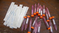 Prečo testujeme len pár desiatok ľudí denne? Tu je vysvetlenie ministerstva zdravotníctva