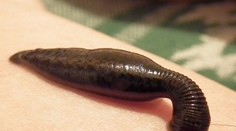 Hrôzostrašný nález. Objavili telo muža vo vani plnej pijavíc