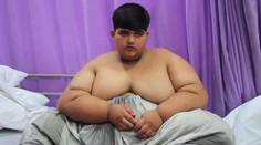 Najtučnejšie dieťa na svete: Má 10 rokov a takmer 200 kilogramov