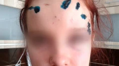 Chytili muža, ktorý znetvoril tvár 16-ročnému dievčaťu z Ružomberka